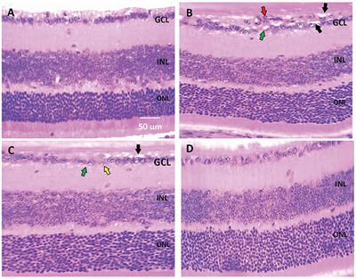 Carbamazepine Alleviates Retinal and Optic Nerve Neural Degeneration in Diabetic Mice via Nerve Growth Factor-Induced PI3K/Akt/mTOR Activation